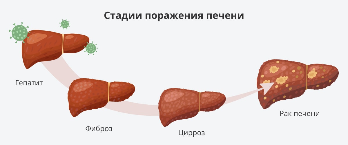 Необычные‌ сны о⁤ печени: глубокая ​символика и интерпретация