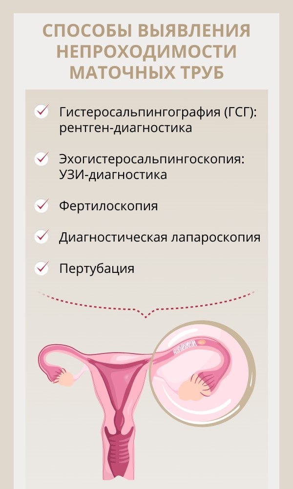 2. Как расшифровать смысл сна про ​эндоскоп: экспертные⁣ рекомендации