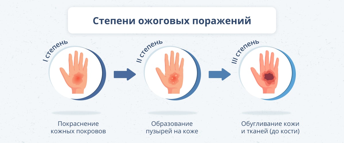 что