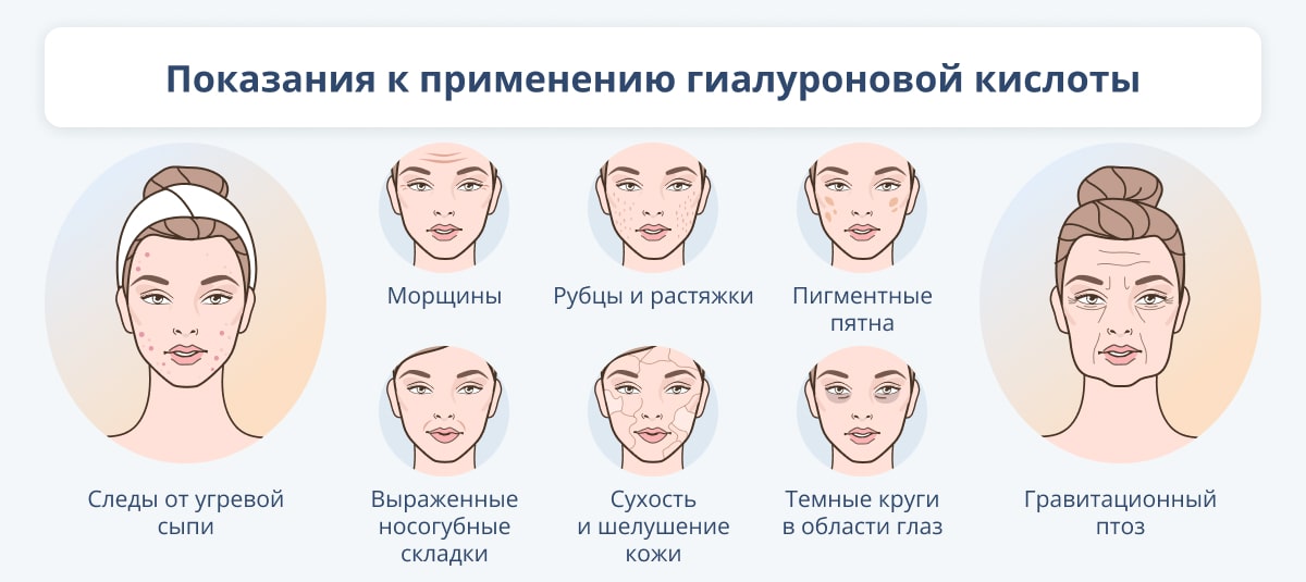 Конечно! Вот список слов