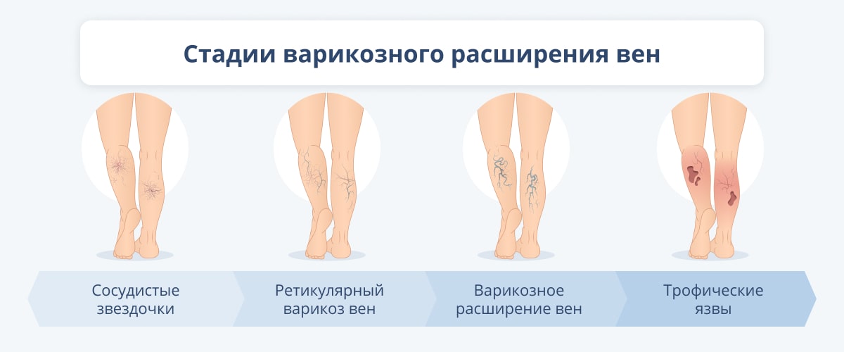 Проникновенные⁣ ощущения и скрытые ‍смыслы: толкование снов⁤ о подкалывании