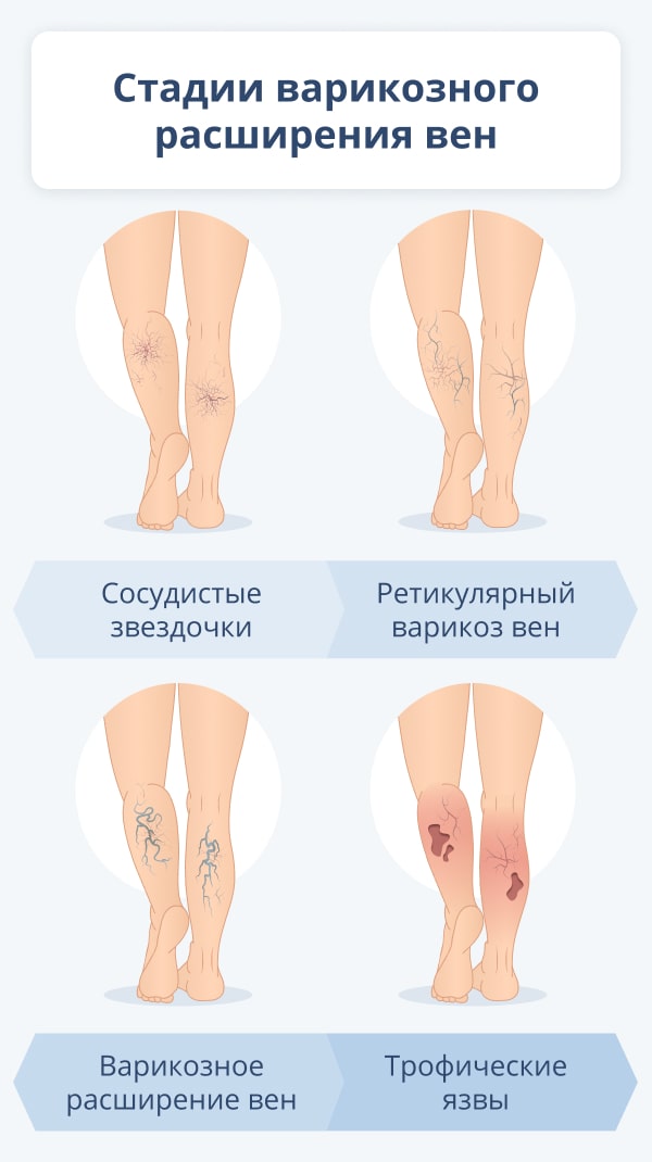 1.‍ Чему
2. Снится
3.‌ Покалывание
4. Снилось
5. Покалывать