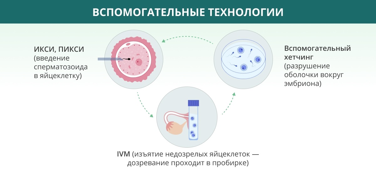 подсадок