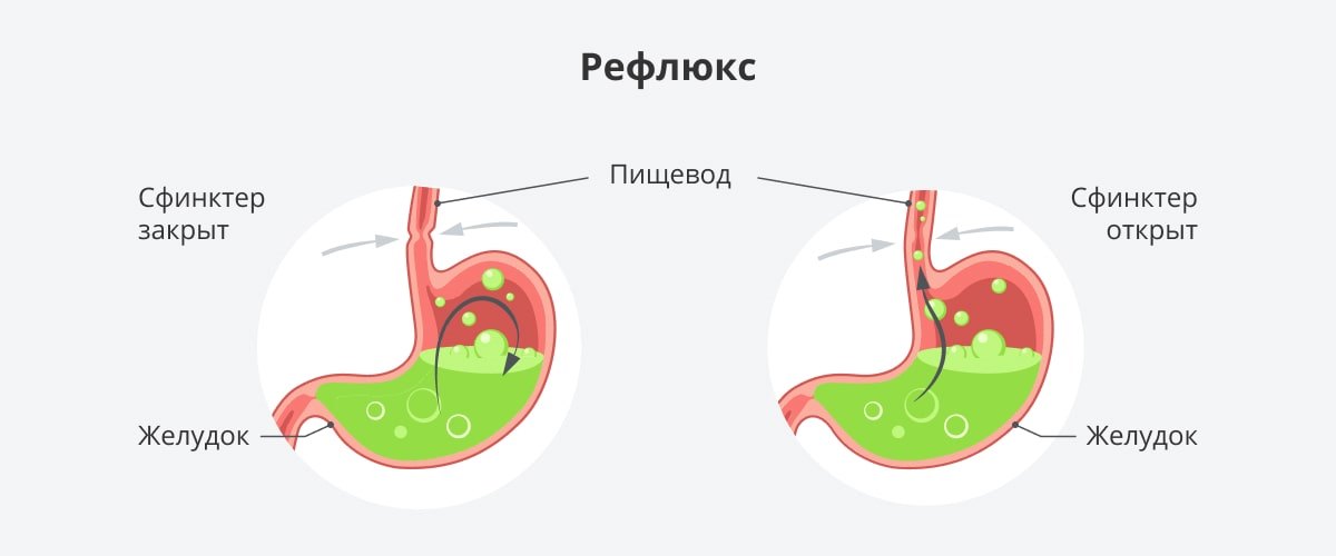 1. Снится
2. ⁤Картон