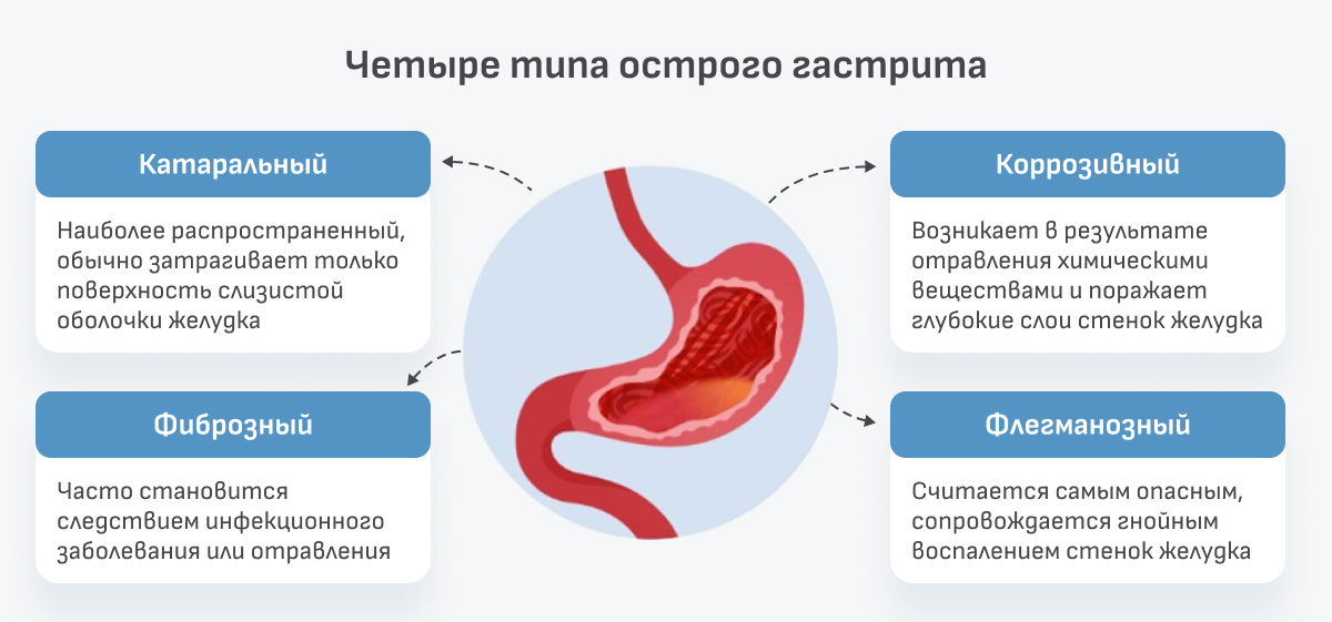 1. Озеленение 
2. Снить 
3. Чему 
4. Сны 
5. Сниски ⁣
6. Озелен 
7. Ленение 
8. Нение