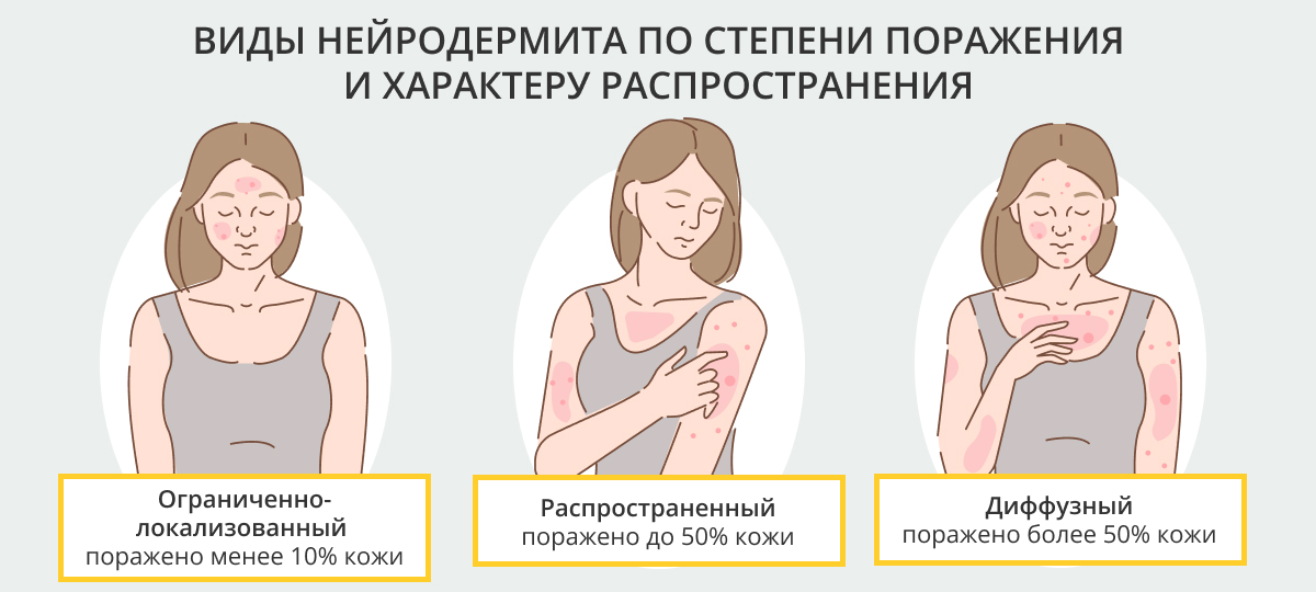 антикоагулянт