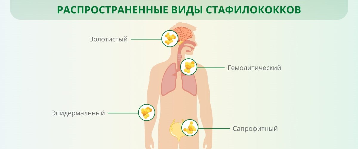 К чему снится ⁢пересдача?