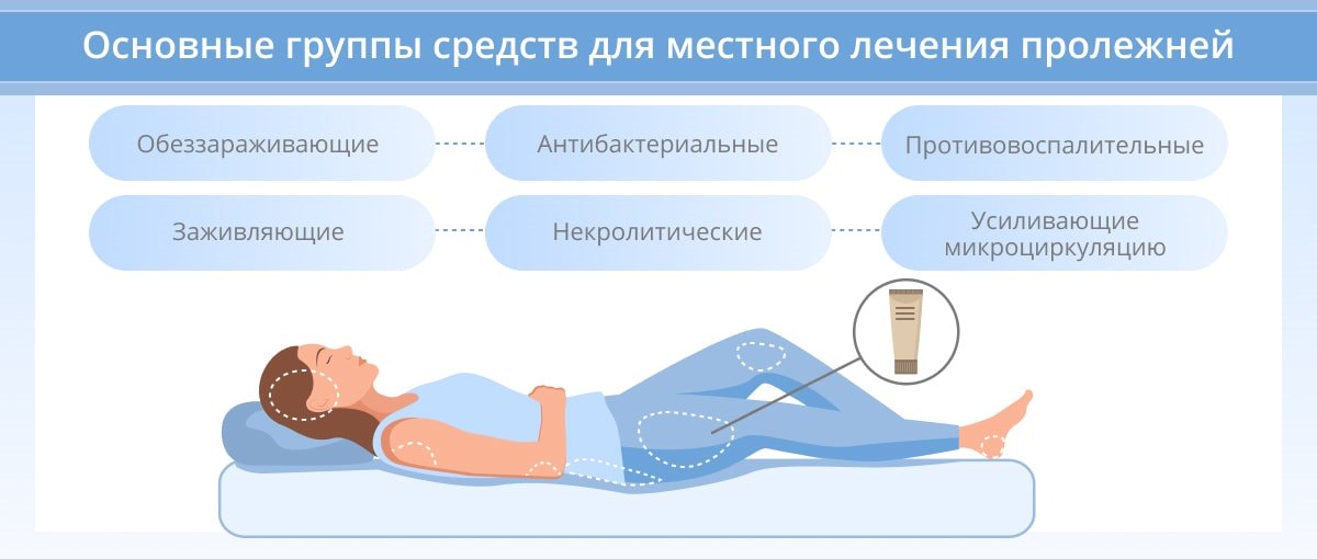 1. снится
2. пух
3. чему
4. к